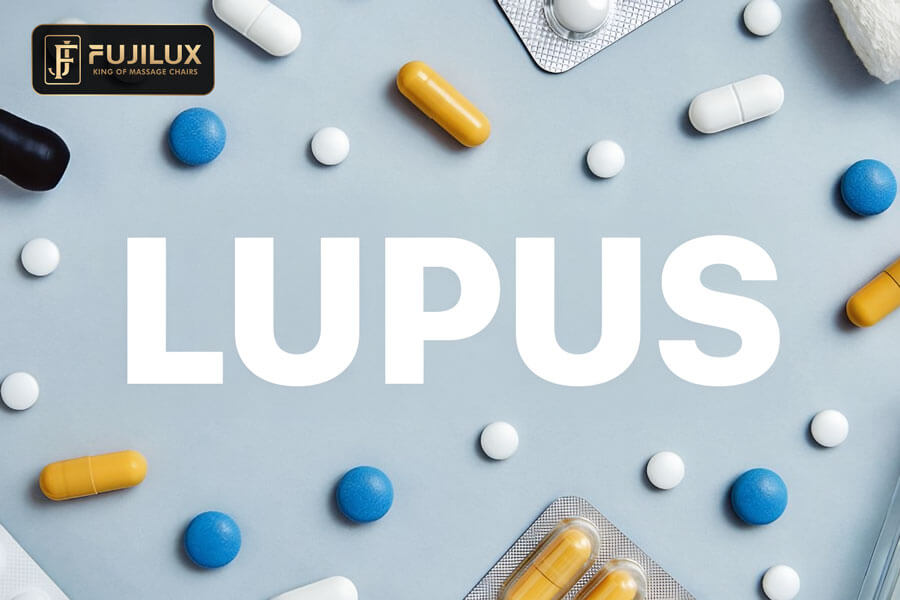 Người mắc bệnh Lupus ban đỏ nên làm gì?
