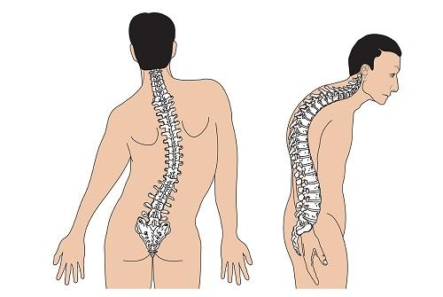 6 thói quen gây hại cho cột sống ai cũng mắc phải mà không biết