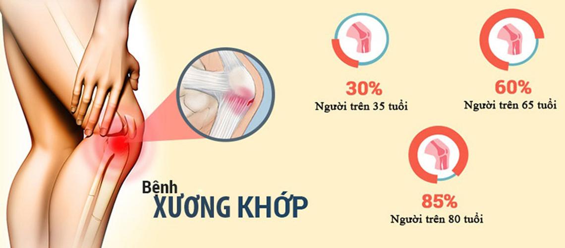 3 Cơ chế massage vô song giúp đẩy lui 7 bệnh xương khớp phổ biến nhất của ghế massage