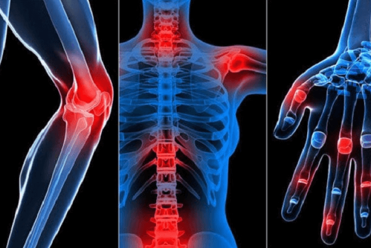 Nhiệt hồng ngoại hỗ trợ giảm đau xương khớp nhanh chóng, giảm co thắt cơ