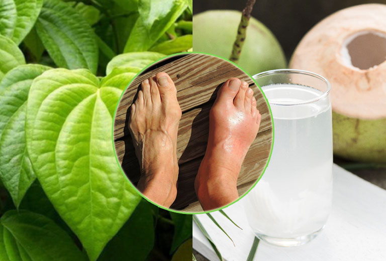 Lá trầu không dùng với nước dừa được xem là bài thuốc dân gian hữu hiệu chữa bệnh Gout